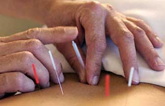 Instituto Médico de Acupuntura - Foto 1