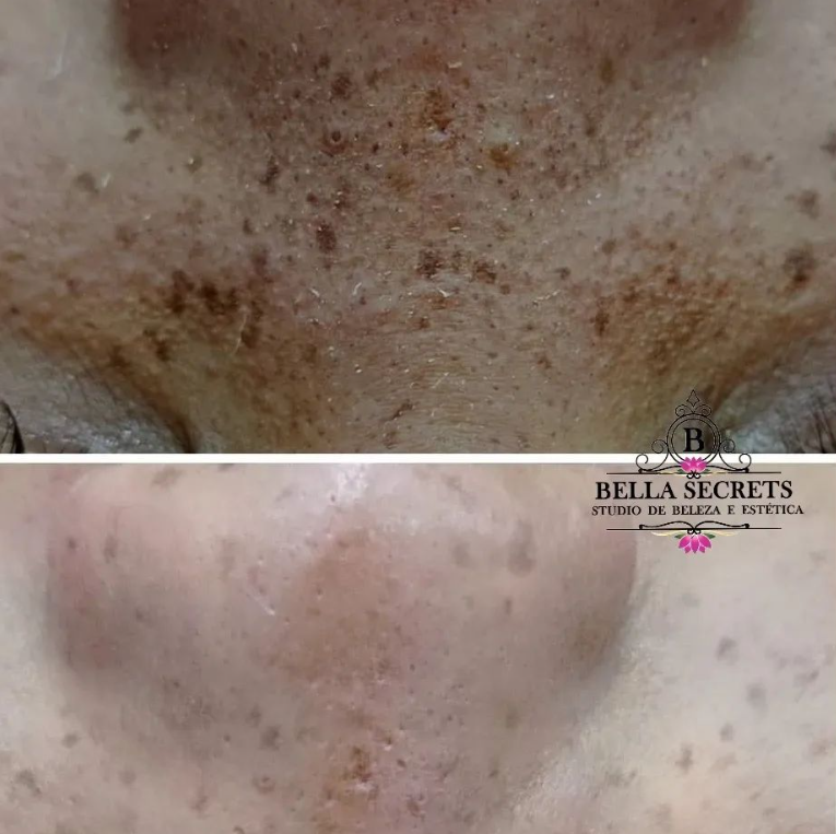 Studio Bella Secrets – Micropigmentação de sobrancelhas fio a fio - Foto 3